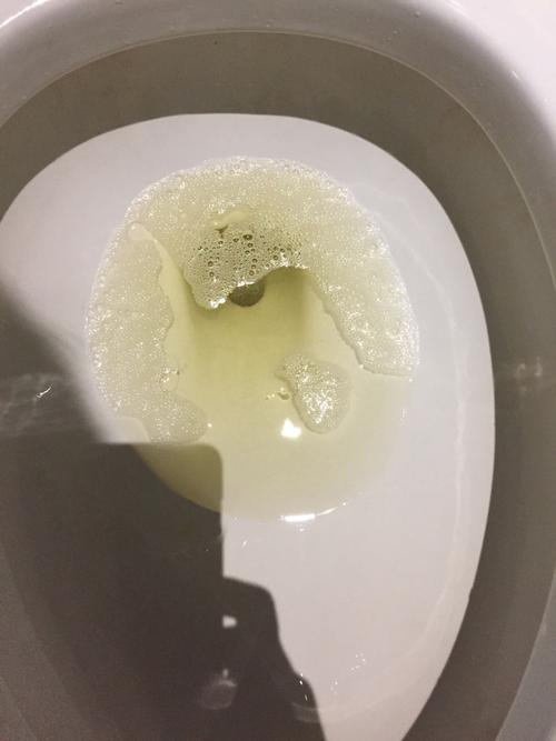 这个算不算小便泡沫多?