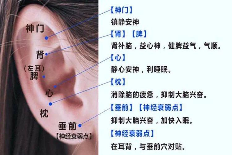 耳朵上粘贴"小豆子",能治的病可不少