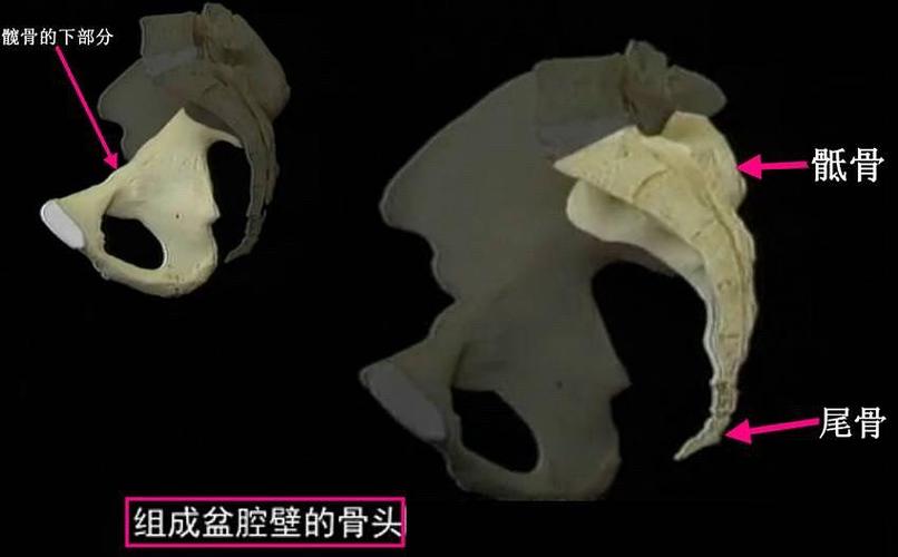 组成盆腔壁的骨头是位于后面的骶骨和尾骨,以及位于前面和侧面的髋骨