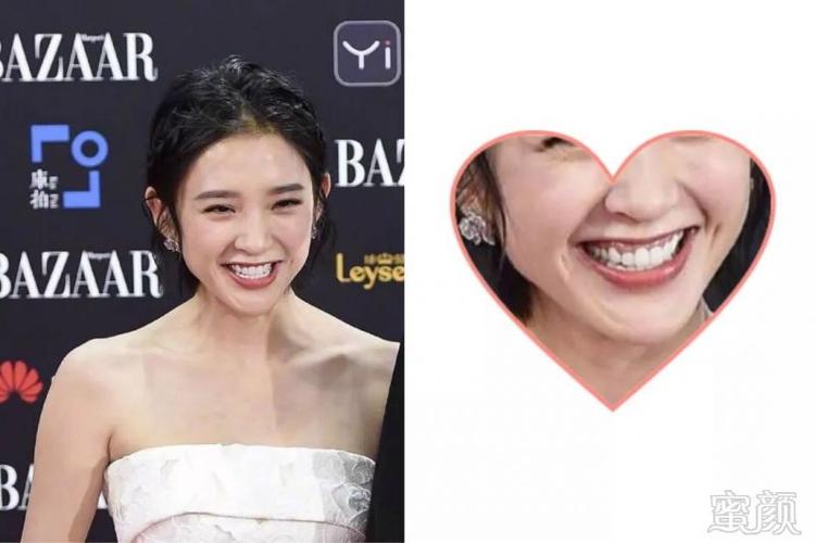 唐艺昕一定后悔动了这里!好怕她以后出问题啊!