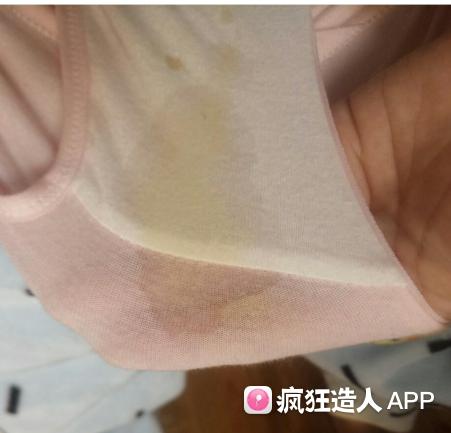 孕中期水样分泌物