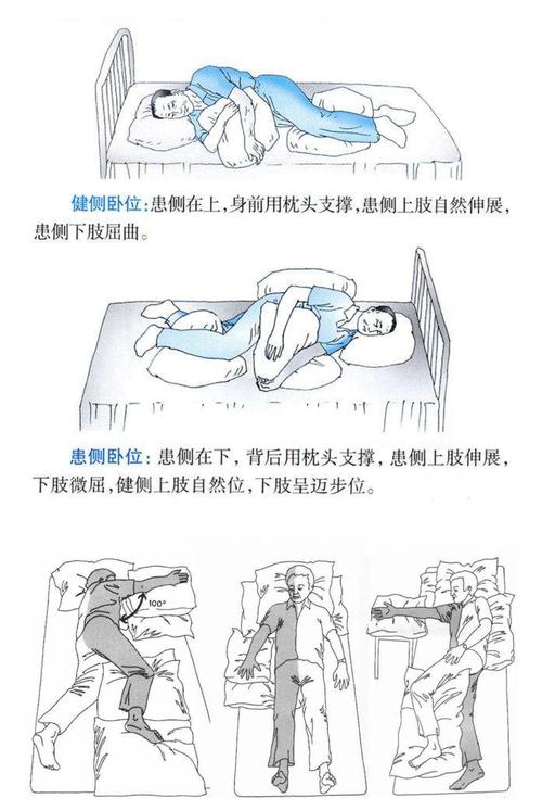 神内患教会(十二)——康复患者健康宣教之床上训练