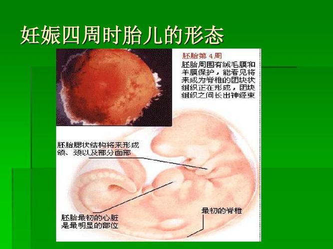 妊娠四周时胎儿的形态