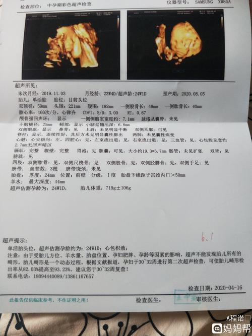 帮里看一下我的四维彩超是男孩女孩,已检查