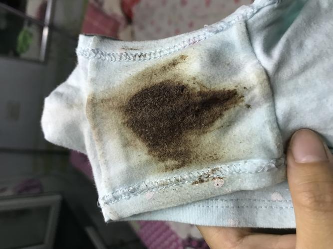 6岁女孩内裤有褐色分泌物是什么东西?