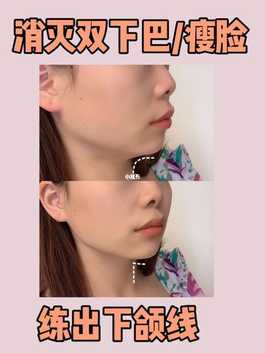 练出下颌线经验分享_下颌线_双下巴_咬肌_下巴后缩_里美怎么样_健身