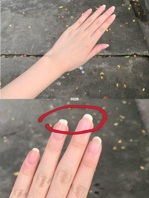 长出来的指甲这个颜色正常吗?_指甲_医疗健康_医疗