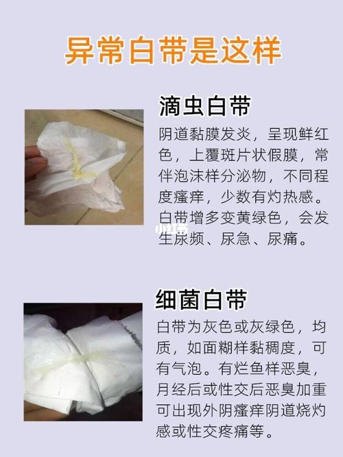 霉菌白带陪伴我几个月,终于把它送走了 不知道是什么时候开始,我就