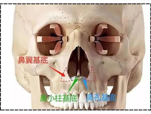 整形前先问问吴闯医生鼻基底整形你了解多少呢