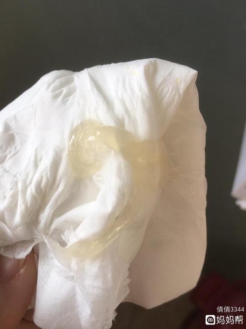 这是不是排卵期白带拉丝