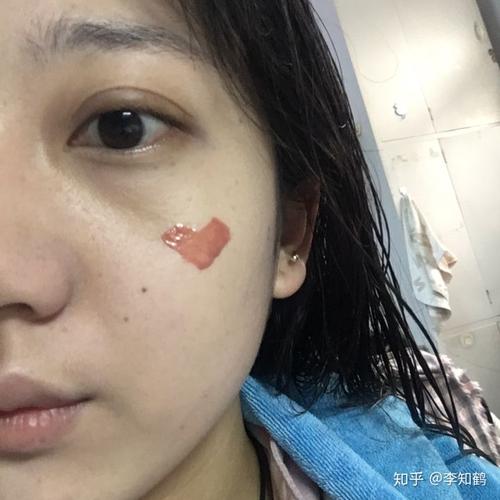 是这样吗 常年熬夜留下重重的黑眼圈(前置无滤镜无p)