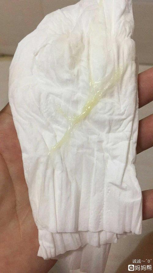 有宝妈孕中期白带突然这样的吗?