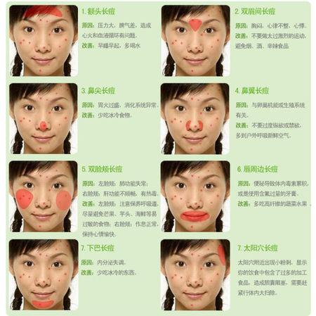 痘痘告诉你哪里生病了 去痘经历