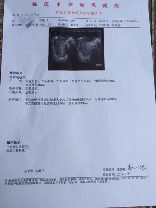 产后42天做的阴超上面的子宫切口小结节是子宫肌瘤吗