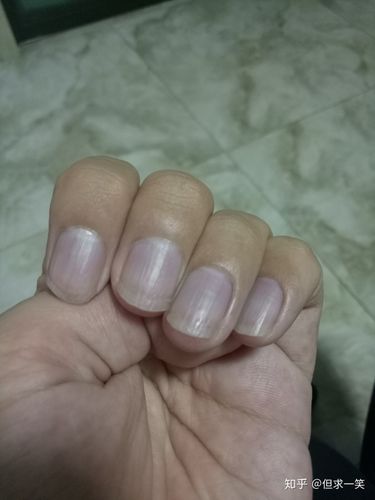 指甲颜色淡紫