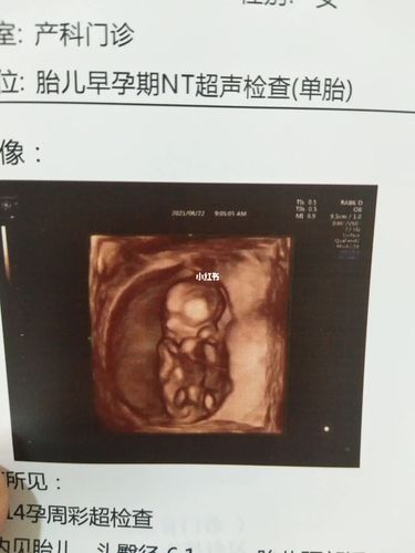 终于熬到12周 ,不知道男孩女孩,一定要健健康康的!