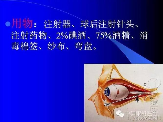 球后注射的详细说明