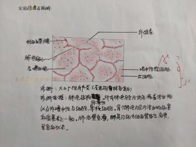 病理学红蓝铅笔绘图