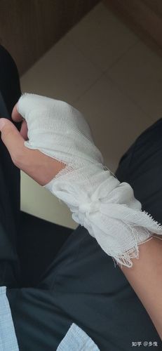 疼的嗷嗷叫,先把伤口处理了,简单包扎.