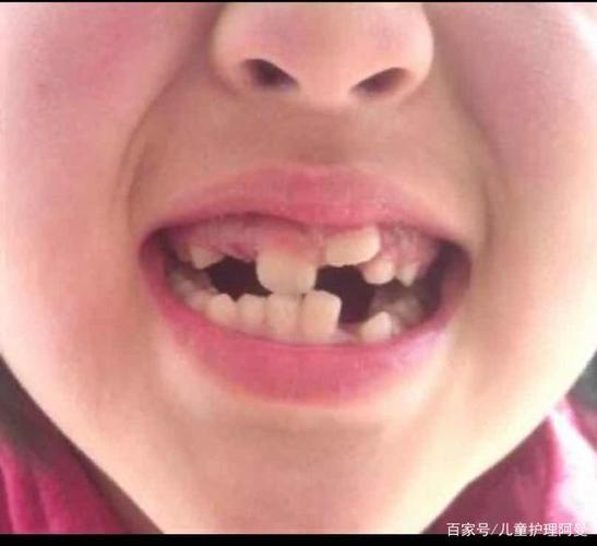 这些习惯很伤牙,你家