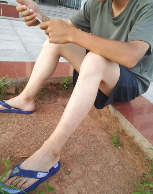 "腿细"的男生怎么穿短裤才好看?跟时尚博主学搭配,简约又帅气