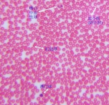 显微镜下的血细胞