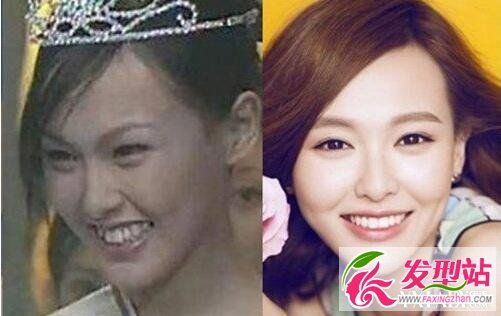 唐嫣整容前后照片