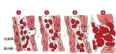 血小板功能不正常需要做哪些检查?