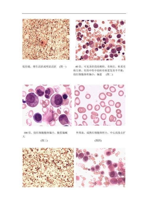 血细胞形态图片