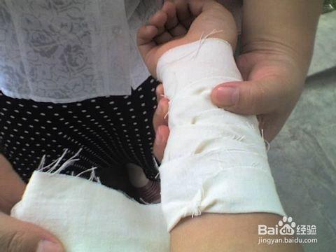 降温冷却后,用干净的纱布覆盖,及时的送往医院治疗.