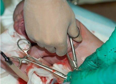 这几张图片揭示分娩时会阴侧切的真相!