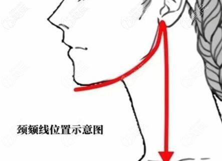 下颌缘位置示意图