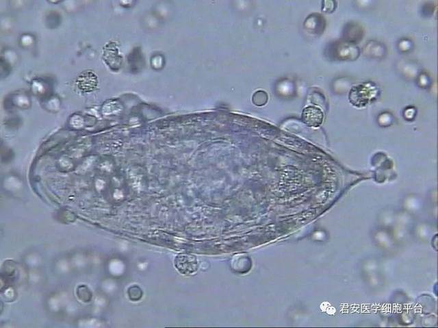 罕见的"花粉孢子"——埃及血吸虫卵