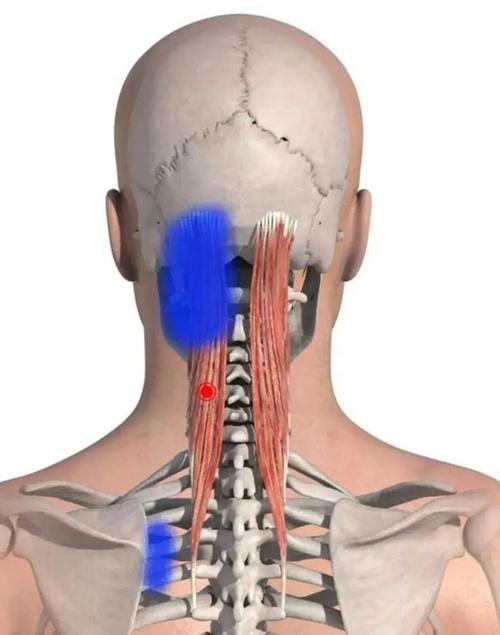 十大与颈椎病有关的肌肉干货分享