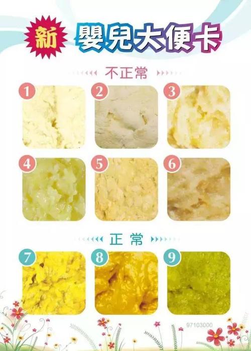 怎样判断新生儿大便颜色是否正常?