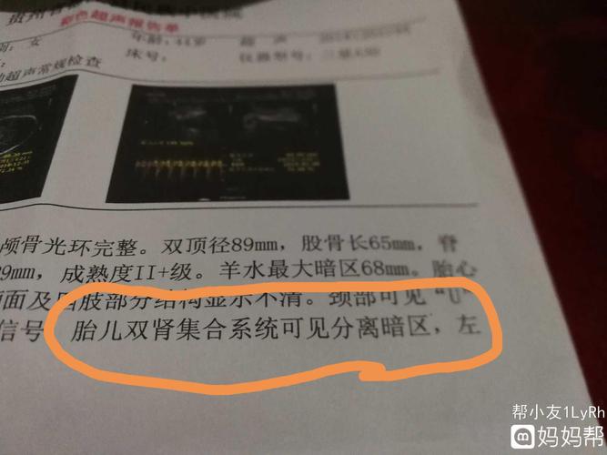 怀孕35周,双肾分离7mm和11mm,正常吗?亲们