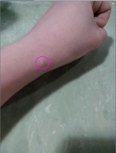 左手腕内侧长了根小刺一样的骨头,是怎么回