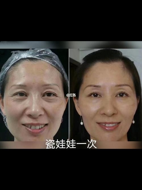 虞美人面部瓷娃娃