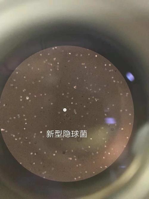 新型隐球菌