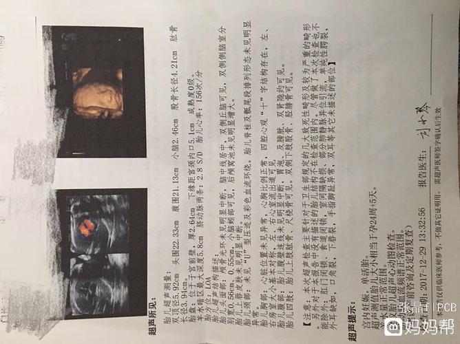 我想让大家看看胎儿嘴巴是不是兔唇 - 2018年4月出生