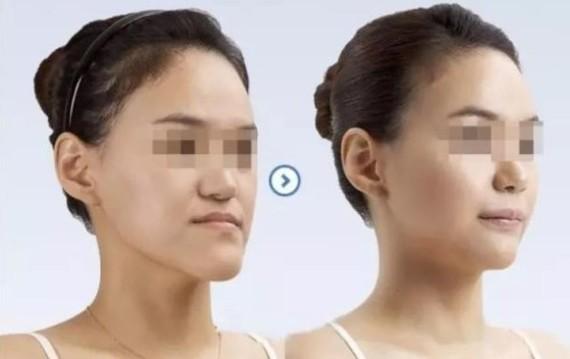 地包天让人看起来有生气的感觉,会增加攻击力.