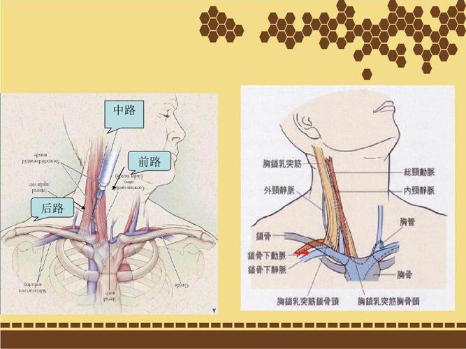 卢氏县第二人民医院结-直肠肛门外科成功开展颈内静脉置管术