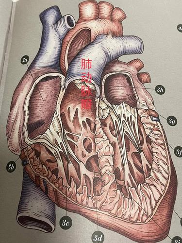 肺动脉瓣狭窄(肺动脉瓣狭窄怎么治疗?