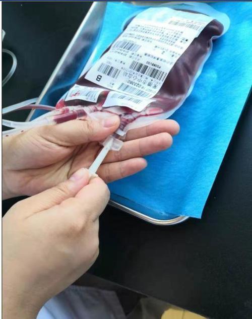 输血时血袋戳破怎么办