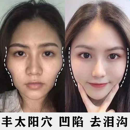 神器全脸精华液丰盈凹陷不要小红去泪推荐可用液态精华