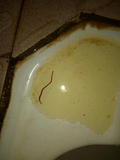 尿 男士 尿出一条红色的虫子 头像吸盘 2--3cm长 还蠕动 本人身体没