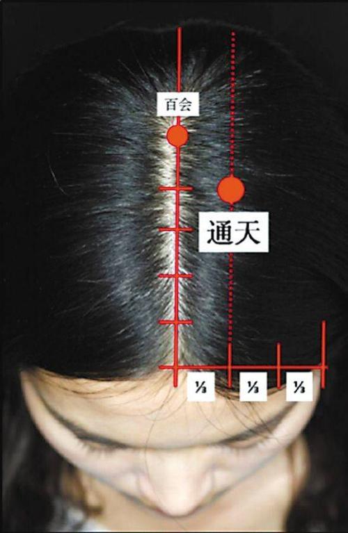 找到"通天穴",远离鼻炎鼻塞