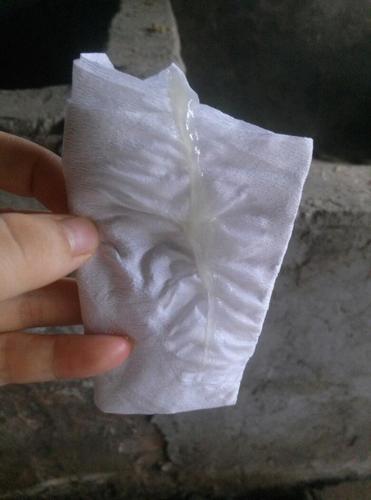 今天出现这个样子的白带,是不是快了,有图慎入