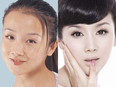 盘点削腮骨的女明星(组图)