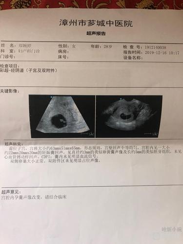 怀孕9周了,做阴超还是看不到心管搏动,好